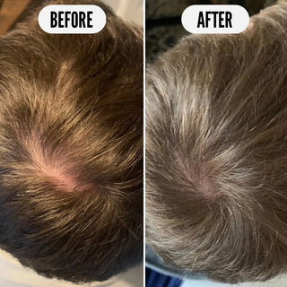 Tónico de Crecimiento Get Set, Grow - 75ml 